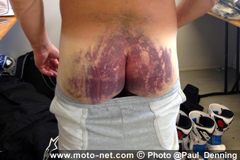 Paul Denning salue le courage de Randy de Puniet