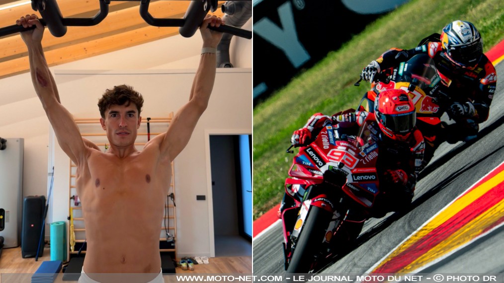 Marc Marquez : une carrière qui coûte un bras